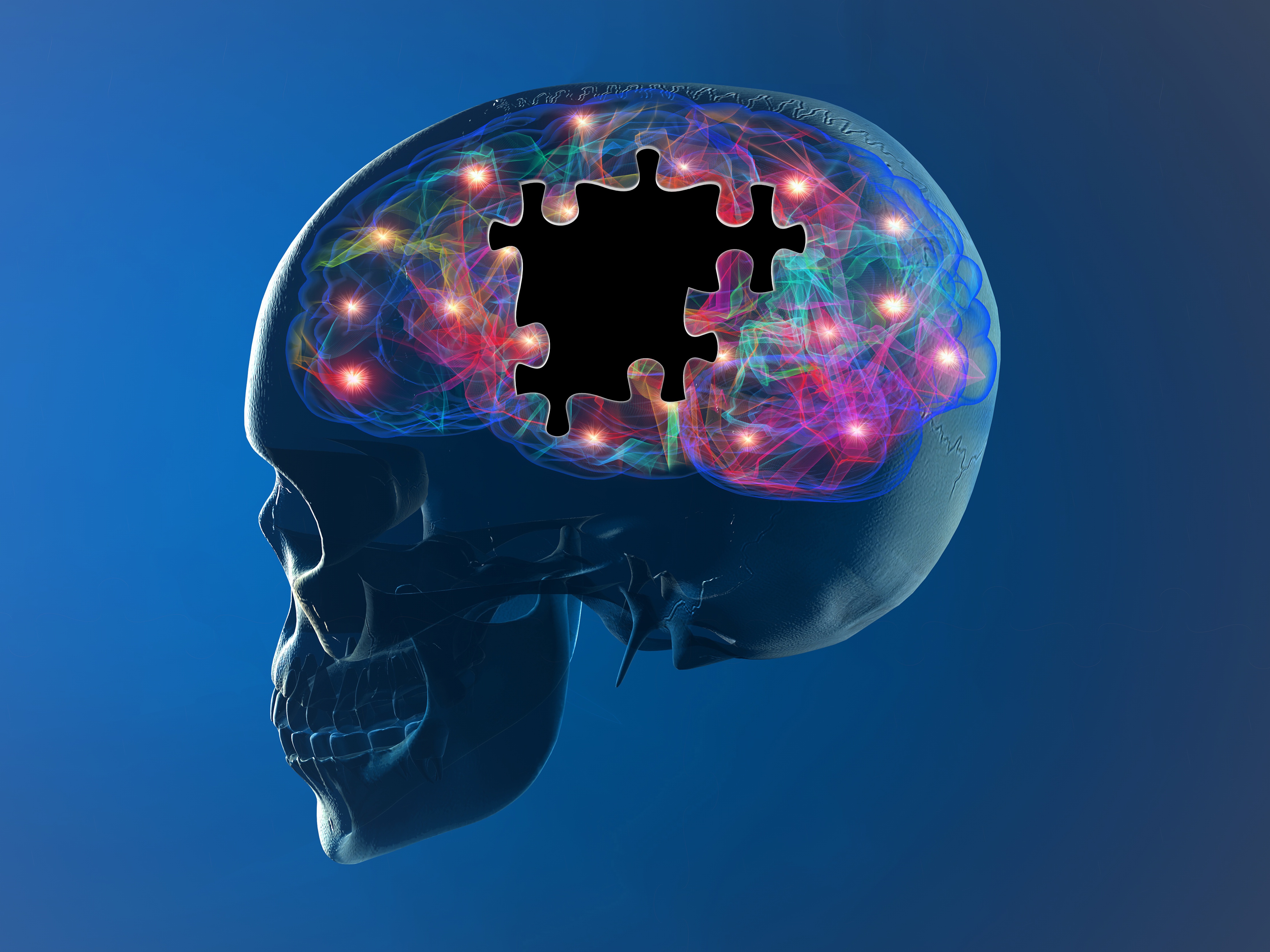 Cervello malattie degenerative Alzheimer, Parkinson