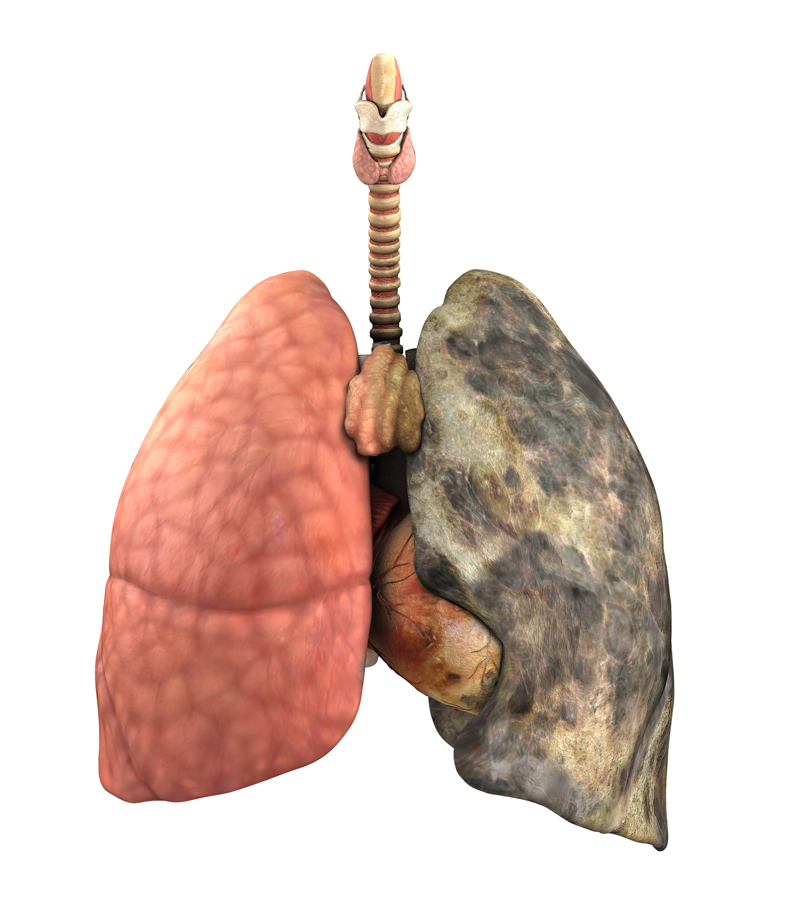 A set of lungs, before and after a lifetime of smoking - 3d render.